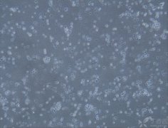 內(nèi)皮祖細胞治療外傷性腦損傷