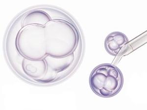 子宮內(nèi)膜間充質(zhì)干細胞與復(fù)發(fā)性流產(chǎn)