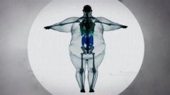 注意：以下人群最易患得脂肪肝，請進行脂肪肝篩查